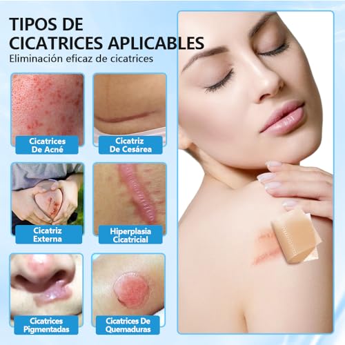 Miniatura 2 de Silicone Scar Sheets,Silicone Scar Tape,Láminas De Silicona De Grado Médico Para,Cesáreas,Quemaduras Y Acné 4cm 150cm ,Transpirables Para Todo Tipo De Piel,Parches Cicatrizantes,Reutilizables