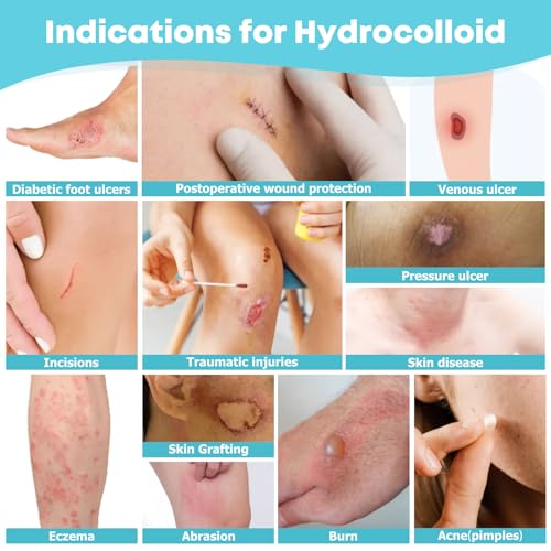 LIFARA Hydrocolloid Roll for Wound Care - Cut-to-Size, Extra Large Hydrocolloid Patch Bandages with Self-Adhesive, Ultra Absorbent, Flexible & Waterproof, First Aid Kit Essential (2in*16ft) - Image 4