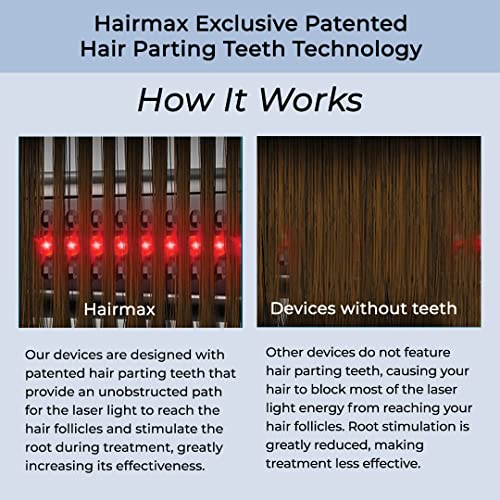 HairMax Faixa de crescimento de cabelo a laser LaserBand 82 ComfortFlex (liberada pela FDA). Tratame