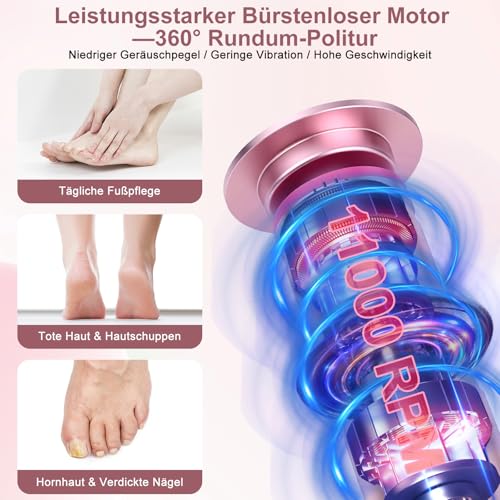 Detaillierte Ansicht der 20 inkludierten Aufsätze: 10 grobe und 10 feine Mikrodiamant-Pads des Glovios Hornhautentferners...