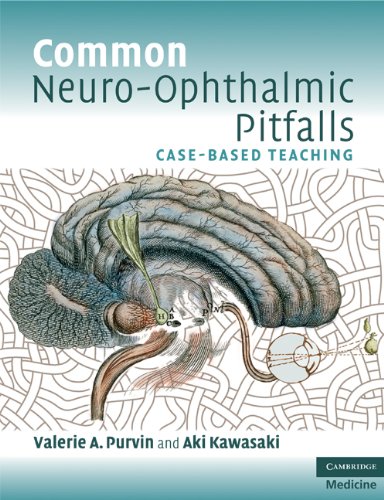 Common Neuro-Ophthalmic Pitfalls: Case-Based Teaching (Cambridge Medicine (Paperback)) (English Edition)