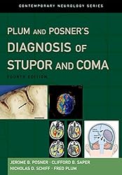 Amazon.co.jp: Plum and Posner's Diagnosis of Stupor and Coma