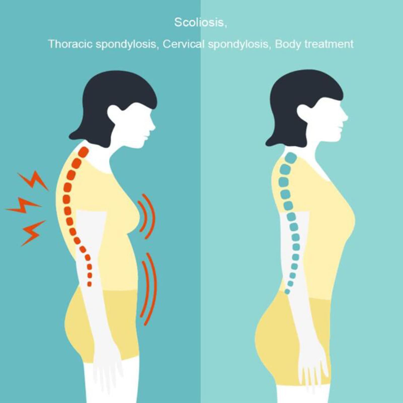 RęCzne NarzęDzie Chiropraktyczne,6 PoziomóW RęCzne NarzęDzie do Regulacji KręGosłUpa Chiropraktyka GłęBoko KojąCy Masaż Stresowy Dla Regulatora Skoliozy MasażEr KręGosłUpa,Yellow