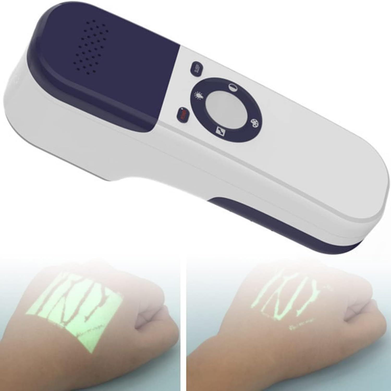 Vein Finder Viewer — przenośny, ręczny wykrywacz żył z akumulatorem — medyczne urządzenia do lokalizowania żył naczyń krwionośnych dla szpitali, klinik i do użytku domowego