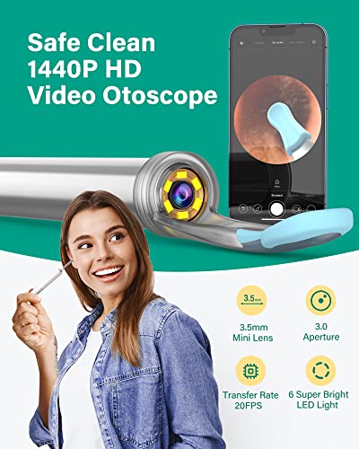 Xlife Ear Wax Removal, 1440P Ear Cleaner Camera, Ear Cleaner with Camera and Lights, Ear Cleaning Camera for iPhone iPad & Android Phones, Ear Cleaning Kit with 4 Pack Blackhead Remover Kit (White)