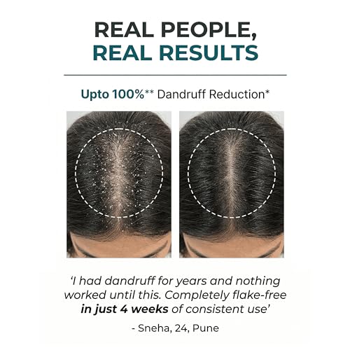 Image of Ravel PRO Anti Dandruff Conditioner | Soothes Scalp Irritation | Reduces Itchiness & Prevents Dandruff | Suitable For All Hair Types | Conditioner for Flake Control | Men & Women - 150ml