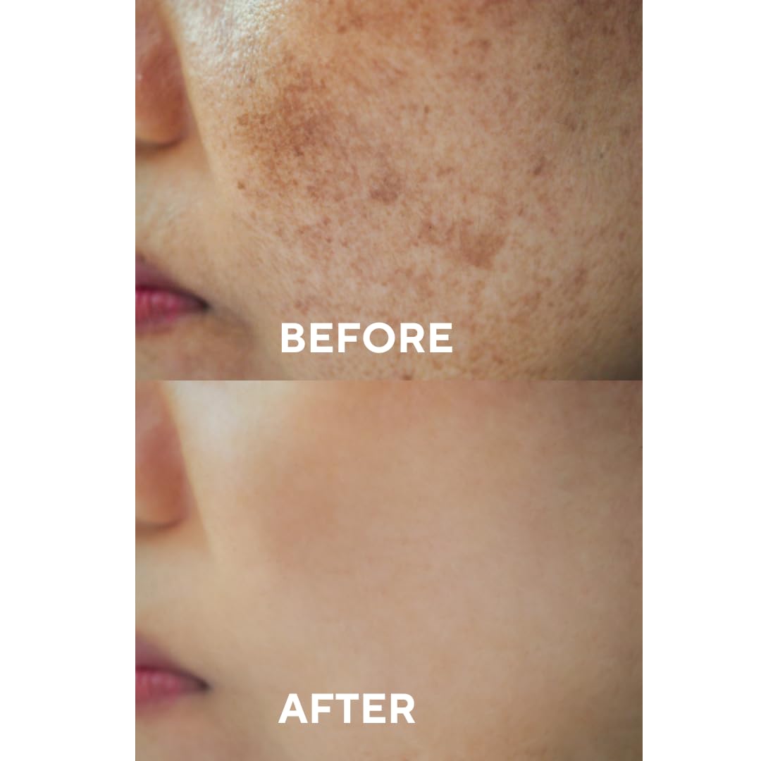 The Ceel Yüz bakım serumu, koyu lekelere karşı, pigment lekelerine karşı, hiyalüronik asitli serum, niasinamid, alfa arbutin, pigment lekesi giderici, yüz 30 ml