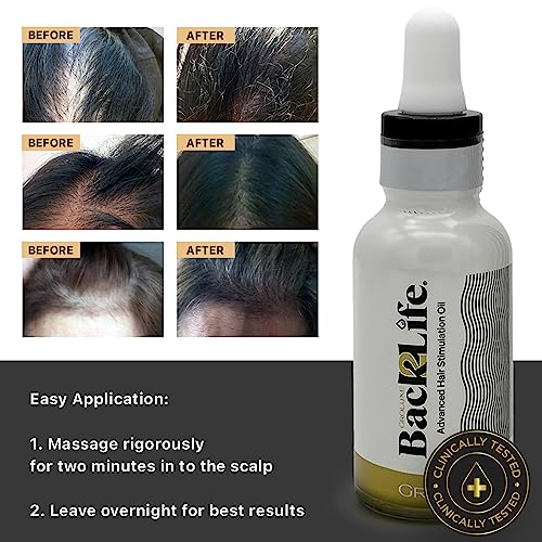 Back2Life 100% Natural Hair Stimulation & Beard Growth Oil-Get Rid of Patchy Beards & Hair-Beard serum to Moisturise, Hydrate & Condition-Repair & Rebalance Your Scalp & Regrow your Head & Beard Hair - Image 3
