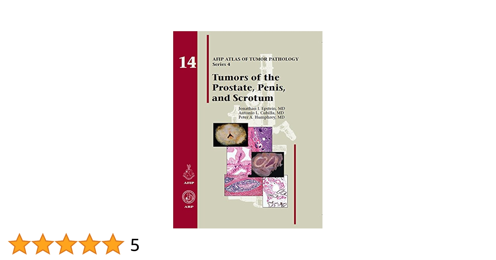 AFIP4th #14 Tumors of the Prostate(新本) Tumors of the Prostate Gland, Seminal Vesicles, and Scrotum