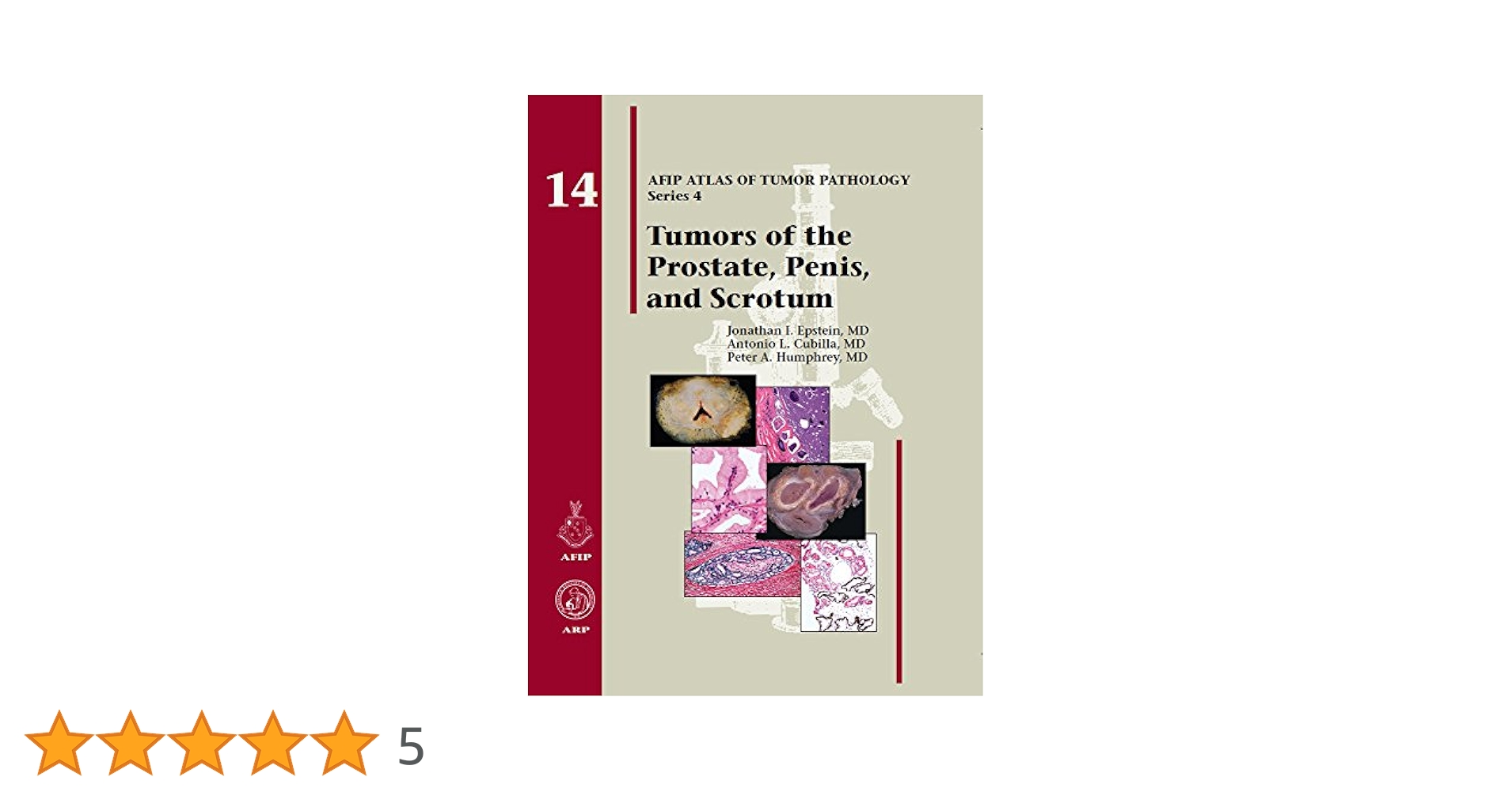 Tumors of the Prostate Gland，Seminal Vesicles，Penis，and Scrotum (AFIP Atlas of Tumor Pathology: Series 4) Epstein，Jonathan I. Amazon | Tumors of the Prostate Gland, Seminal Vesicles
