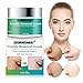 Freckle Cream,Dark Spot Corrector,Skin Lightening Cream,Freckle Remover,Bleaching Cream Freckle Removal Cream for Face and Body Hyperpigmentation Age Spot Freckles Melasma