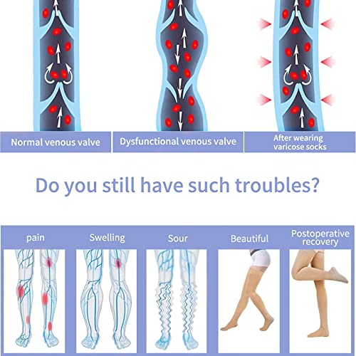 Totexil Compression Stockings For Women & Men, 15-20Mmhg Thigh High Compression Socks,Closed Toe Medical Compression Socks With Silicone Dot Band-Best Support For Running Nursing Sports Varicose Veins #TOP4