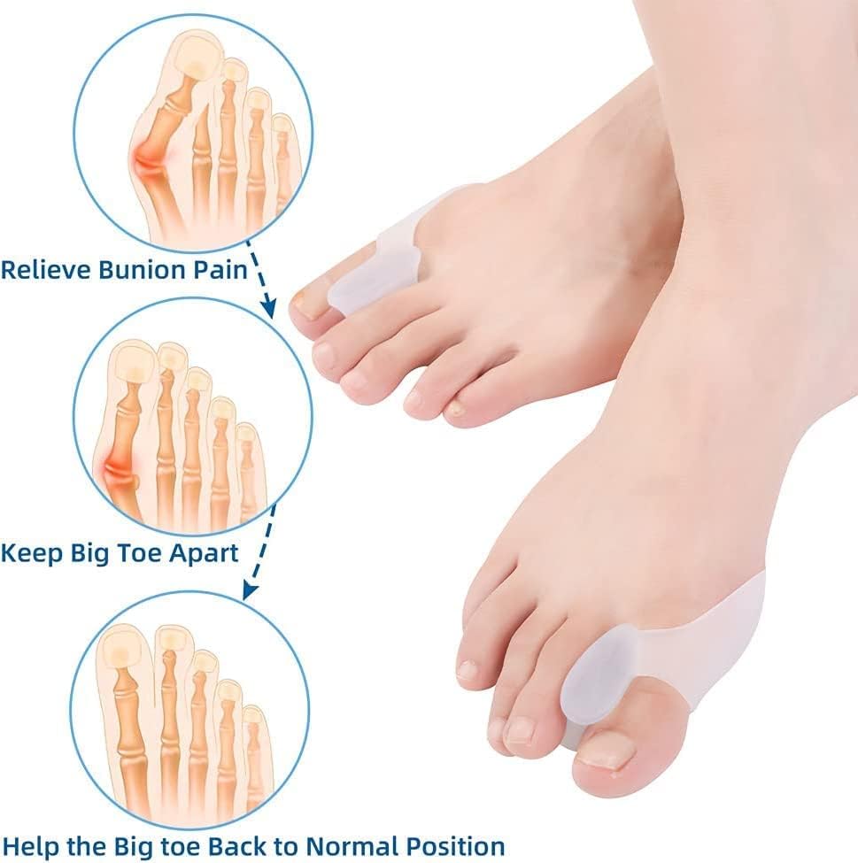 Image of Bunion Corrector Silicone Toe Separators For Fast Pain Relief - Orthopedic Bunion Spacers Spreader Free Size (Toe Separator)