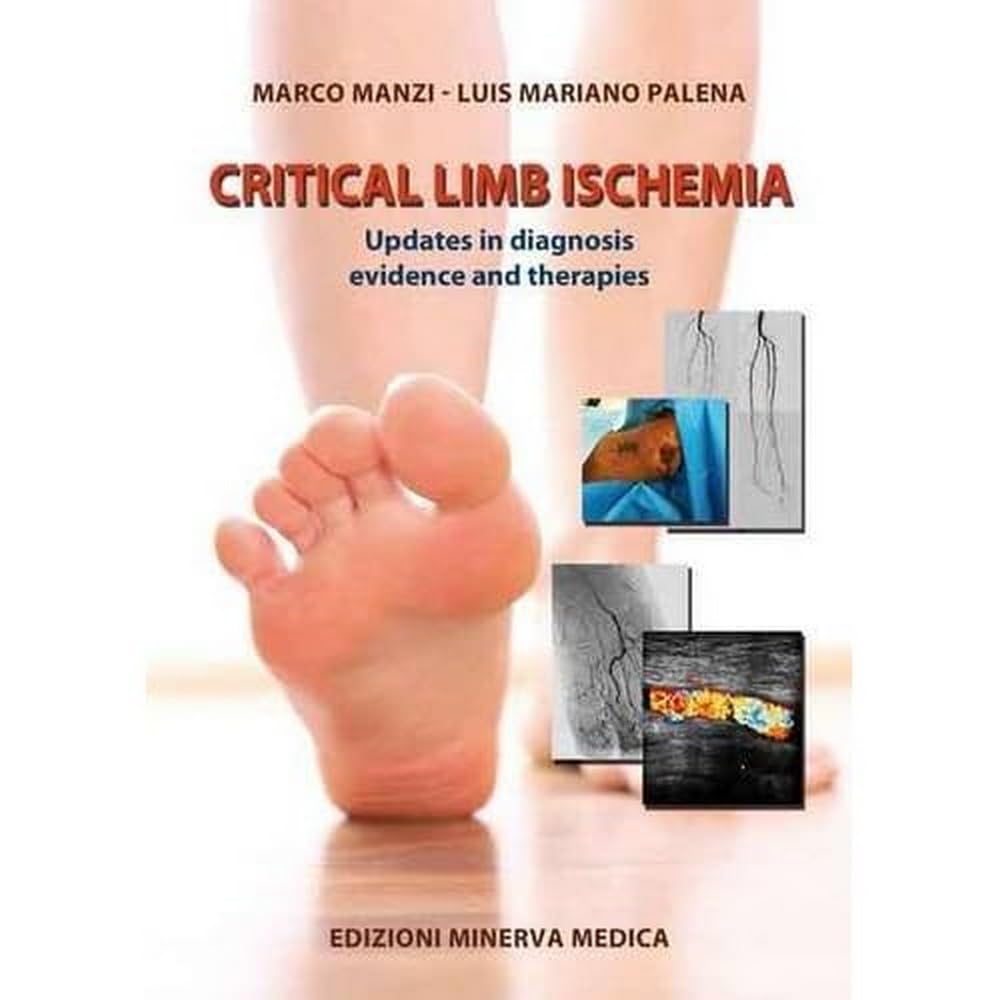 Critical limb ischemia. Updates in diagnosis evidence and therapies