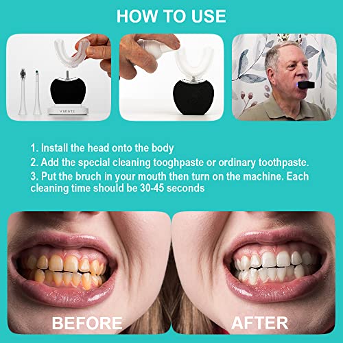 V-White Electric Toothbrush Adults - Ultrasonic U-Shaped Toothbrushes For Teeth Whitening - 360° Mouth Cleansing, Hands Free Gums Protection - Wireless Charging & Led Light - Waterproof Ipx7 Certified #TOP2