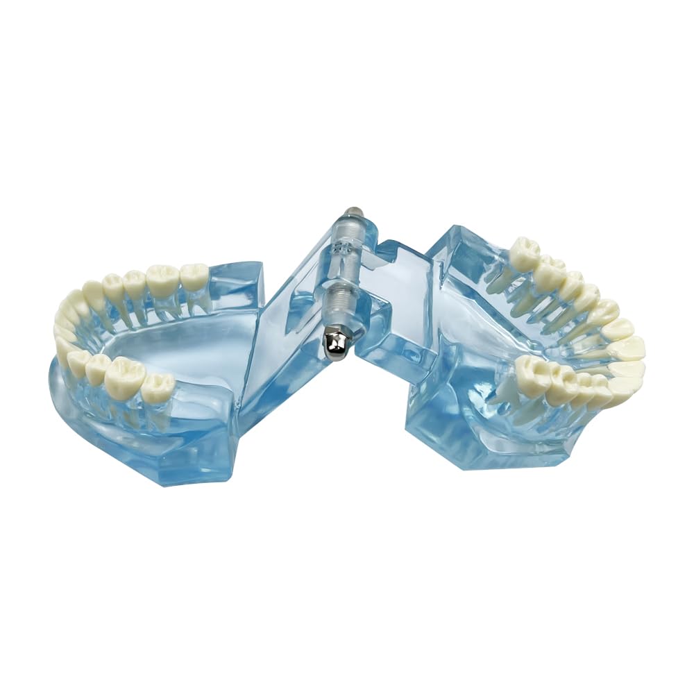 1PC Transparent Normal Dental Model, Teeth Dental Teaching Model, Mouth Model for Dentistry Education and Training Demonstrations (Blue)