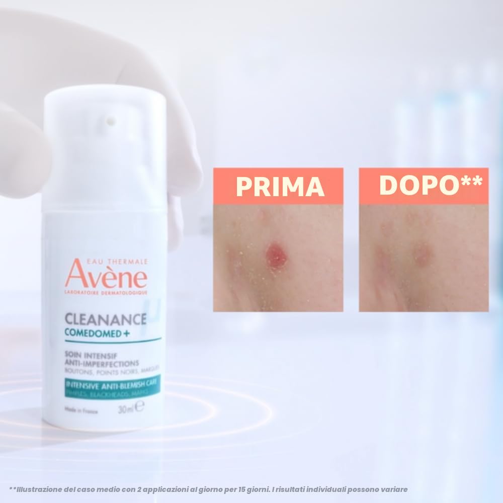 Eau Thermale Avène Cleanance - Comedomed+ Trattamento Intensivo Quotidiano Anti-Imperfezioni, 30ml