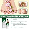 30ml Riparazione Unghie Liquida,Cura delle Unghie,Rinforza la Struttura Dell'Unghia,Nutre e Lenisce le Unghia per un Aspetto Sano e Splendente,Riparazione Delle Unghies Dei Piedi Donne e Uomini