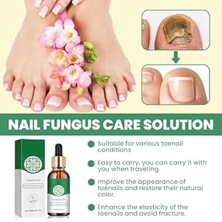 30ml Riparazione Unghie Liquida,Cura delle Unghie,Rinforza la Struttura Dell'Unghia,Nutre e Lenisce le Unghia per un Aspetto Sano e Splendente,Riparazione Delle Unghies Dei Piedi Donne e Uomini