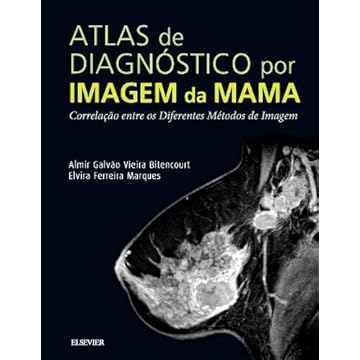 Capa do livro Atlas de diagnóstico por imagem de mama