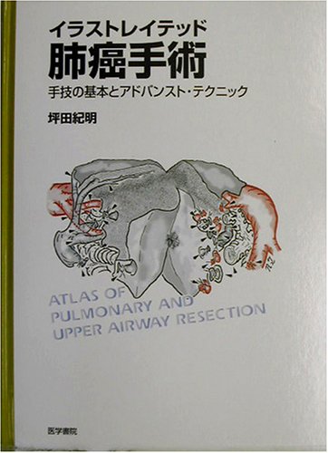 イラストレイテッド肺癌手術[DVD付]―手技の基本とアドバンスト・テクニック [大型本] 坪田　紀明 イラストレイテッド肺癌手術[DVD付]―手技の基本とアドバンスト