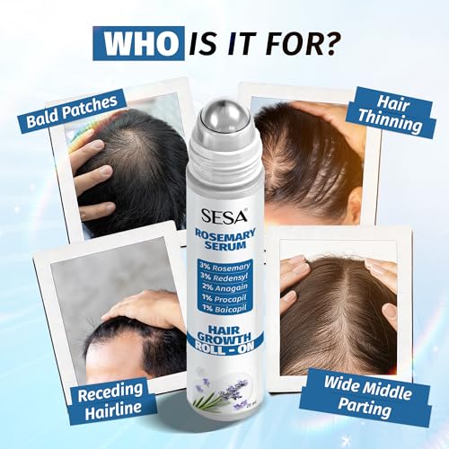 Image of Sesa Rosemary Hair Growth Serum Roll-On, 25 ml | With 3% Rosemary, 3% Redensyl, 2% Anagain, 1% Procapil & 1% Baicapil | For Hair Fall Control & Hair Density | Precision Roll - on for Targeted Scalp Application | Lightweight & Non-Sticky | For Men & Women