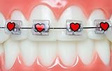 Snapcaps Braces Bumper Cover, Orthodontic Bracket Wax Substitute, Alternative Snap-on Braces Guard Braces Accessories 10 pack (Hearts)