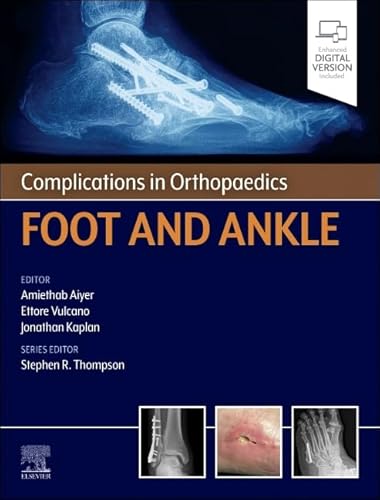 Complications in Orthopaedics: Foot and Ankle