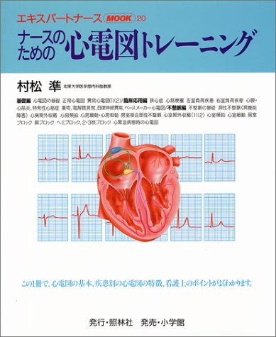 ECGケース・スタディー [単行本] 村松 準 楽天市場】ECGケース・スタディー [単行本] 村松 準 : 参考書専門店