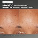 Dermalogica Daily Microfoliant, Face Exfoliator Scrub Powder with Salicylic Acid and Papaya Enzyme, Achieve Brighter, Smoother Skin Daily - Image 5