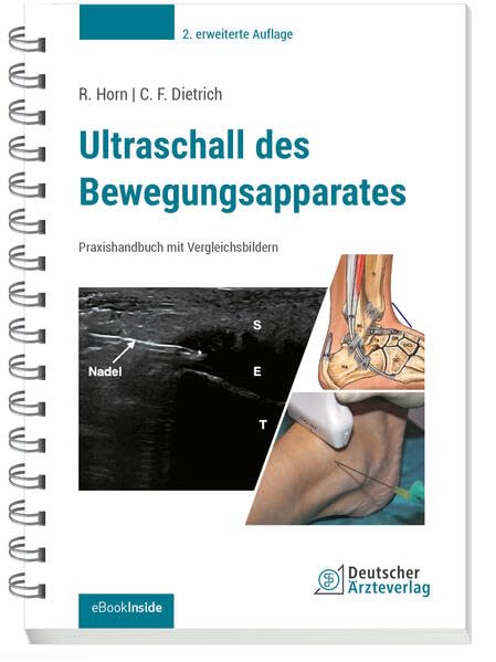 Ultraschall des Bewegungsapparates: Praxishandbuch mit Vergleichsbildern