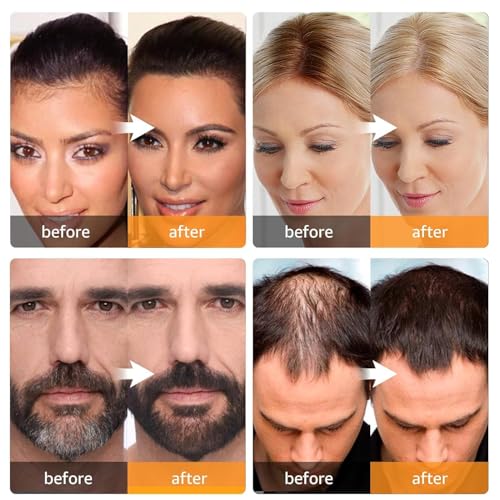 Image of Natural Hairline Powder, Hair Shading Sponge Pen, Hairline Shadow Powder Stick, Quick Root Touch-Up Eyebrow Stamp Root Cover Up Hairline Black Root Touchup 4gm For Women And Men (BLACK, 4G)