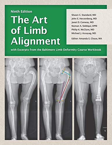 The Art of Limb Alignment with Excerpts from the Baltimore Limb Deformity Course Workbook