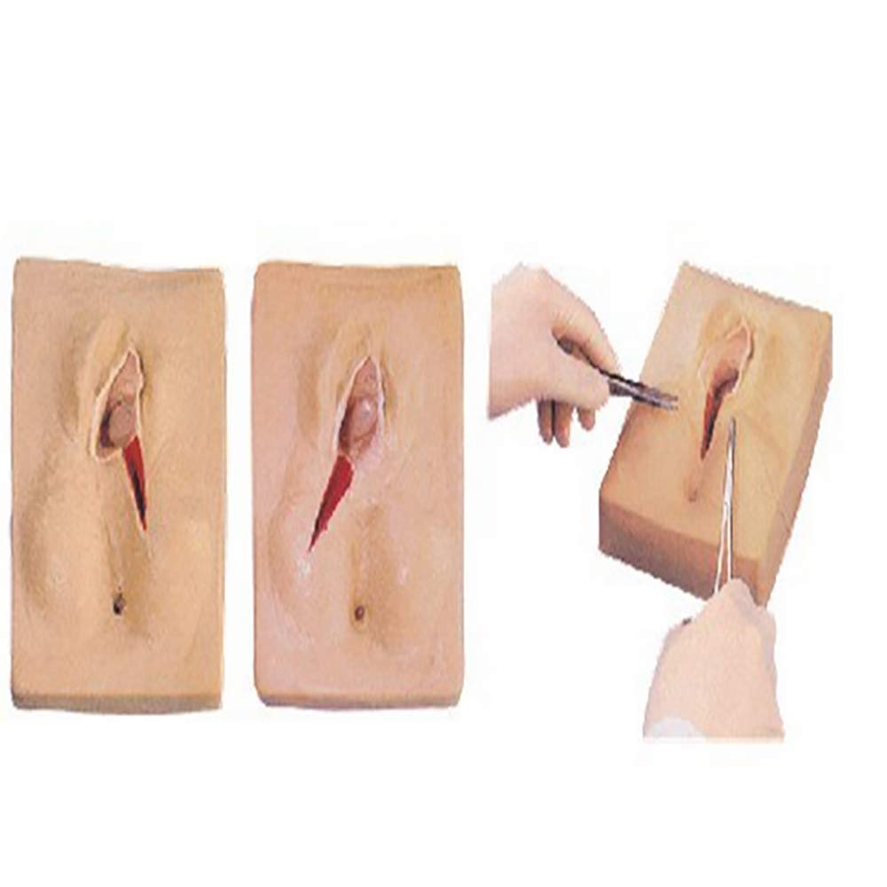 Buy QBNG Your Design Medical Vulva Lateral Perineal Laceration