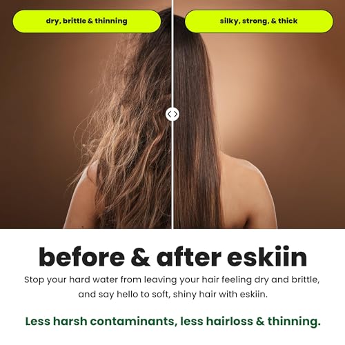 Image of Eskiin Filtered Showerhead - Best Shower Head With Filters For Healthy Hair & Skin - High Pressure Hard Water Softener - Reduce Dandruff, Protect Colored Hair, And Soothe Dry Skin (Brushed Nickel)