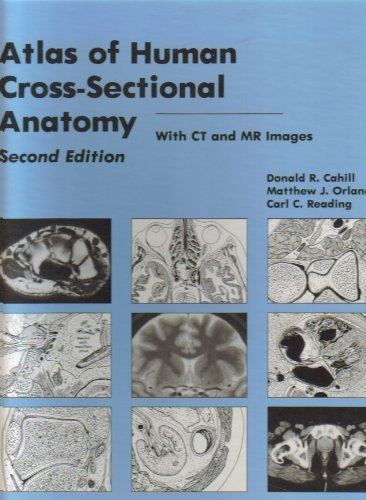 Atlas of Human Cross-Sectional Anatomy 0471509884 Book Cover