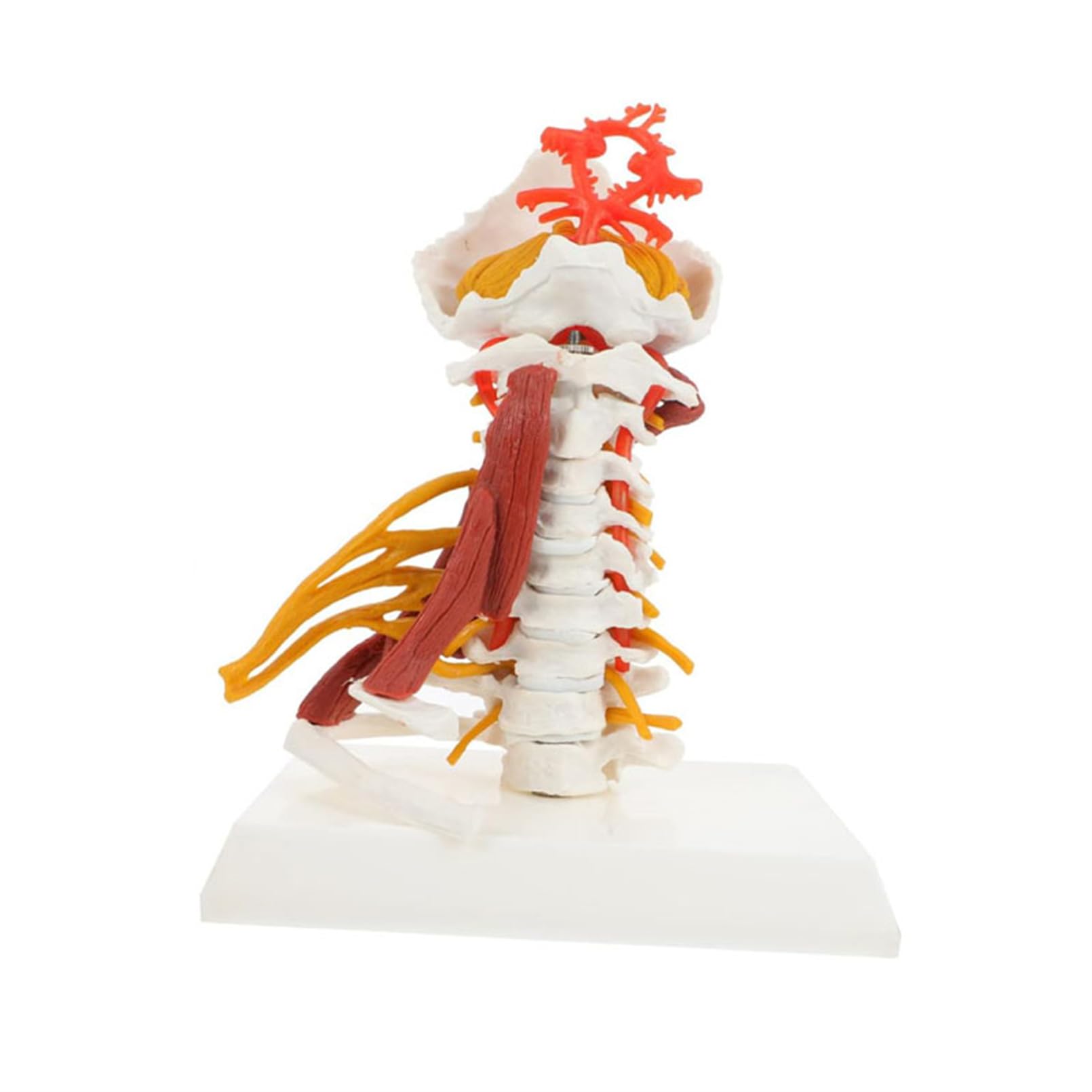 Modèle d'araignée cervicale AMITD anatomie humaine avec tronc cérébral et nerfs