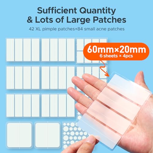 image for TKTK Large Pimple Patches for Face, 7 Sizes XL Acne Patches, Big Hydro