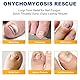 Fungal Nail Patches-32 Stück, Nagelpilz Pflaster,Aktive Nagelreparatur & Pflege.
