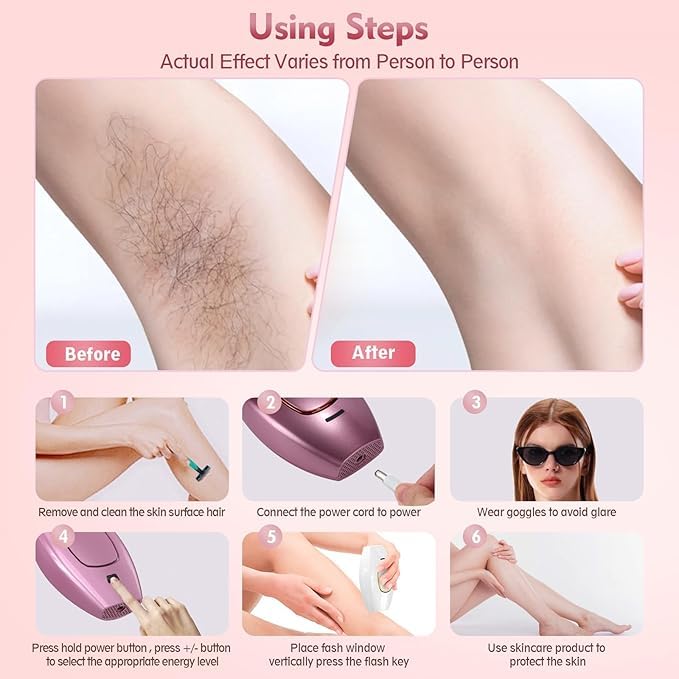 Aryalush IPL PULSE ÉPILATEUR À LUMIÈRE PULSÉE(Rose)