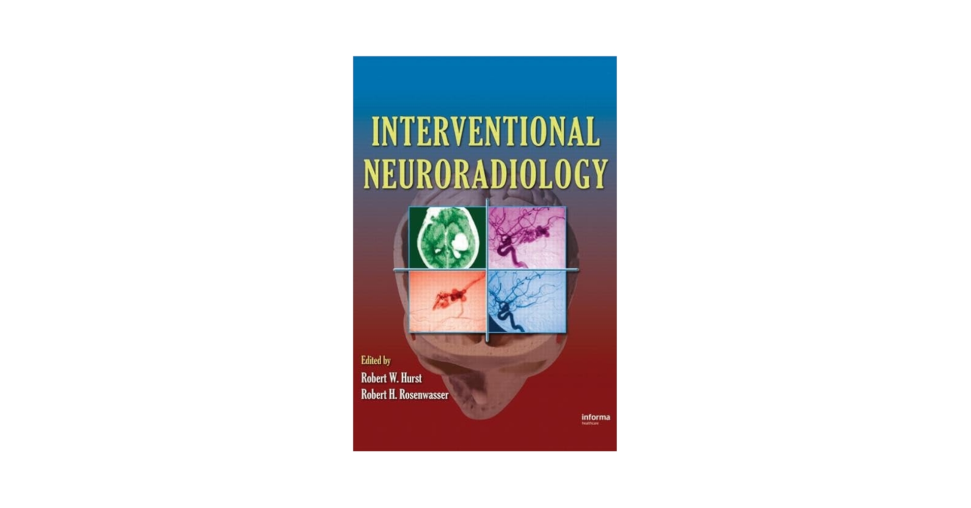 Interventional Neuroradiology: 9780849395628: Medicine & Health