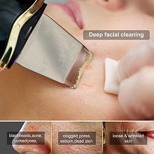 Qukot Ultrasonic Skin Scrubber Spatula - Upgraded Blue-Light Blackhead Remover Pore Cleaner Face Scraper Comedone Pimple Zit Extractor Facial Deep Cleaning Machine For Women Men #TOP3