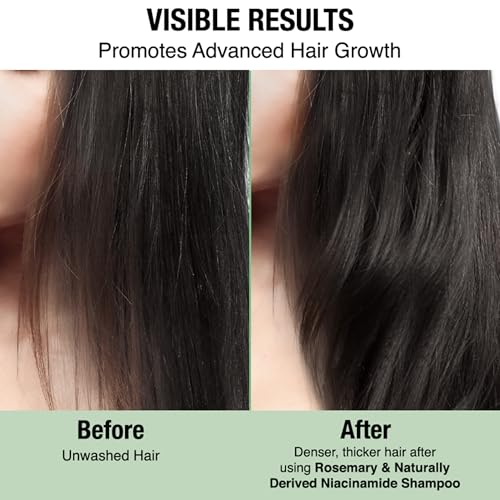 Image of Nykaa Naturals Rosemary & Naturally Derived Niacinamide Sulphate Free Shampoo| Promotes Advanced Hair Growth| Soothes Scalp| Nourishes Hair| Suitable for All Hair Types