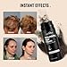 SNOWSEN Hair Fibers for Thinning Hair, Dark Brown, Professional 5-in-1 Hair & Beard Styling Set, Include Applicator Pump, Fiber Hold Spray, Application Card, Hairline Comb,Hair Powder for Women & Men