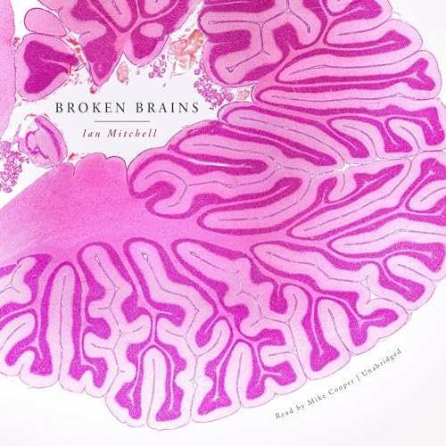 Broken Brains cover art