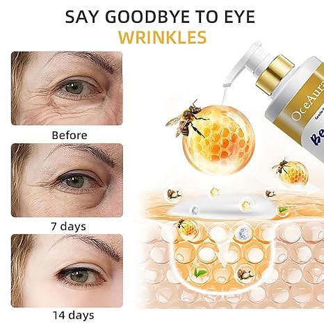 Miniatura 5 de BeeLift Crema reafirmante antienvejecimiento, 2025 nueva crema profesional reafirmante de piel de veneno de abeja reductora de arrugas, pasta