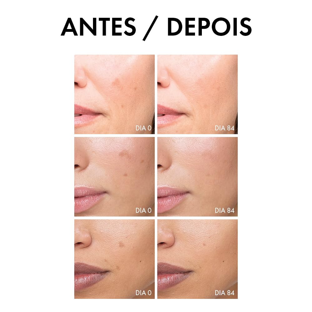 Vichy Liftactiv Pigment Specialist, Sérum Antimanchas, Clareador Facial, Reduz Melasma e Manchas Solares, Uniformiza o Tom Com Tecnologia Melasyl, Niacinamida B3 e Ácido… em promoção! Veja a oferta e mais achadinhos de Tratamentos 9 Hoje é o melhor dia para comprar Vichy Liftactiv Pigment Specialist, Sérum Antimanchas, Clareador Facial, Reduz Melasma e Manchas Solares, Uniformiza o Tom Com Tecnologia Melasyl, Niacinamida B3 e Ácido… com aquele preço maroto! Promoção! Aproveite a oferta! 9