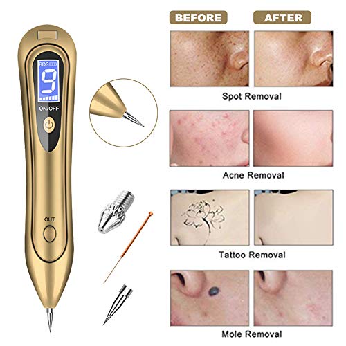 Muttermal Entfernen, Warzen Entfernen, Mole Removal mit 9 Stärke Stufen für alle Arten von haut-tag (Warzen, Muttermale… - Image 7