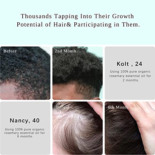 Multipurpose Rosemary Oil For Hair Growth, Eyebrow, Eyelash, Beard& Thinning Hair, Nourish Scalp, Improve Blood Circulation, Hair Loss Treatment, 100% Pure Organic Natural Rosemary Essential Oil #TOP1