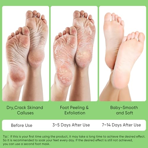 Berlaney Aloe Vera Foot Peeling Mask, Baby Feet Exfoliating Peel for Dead Skin Removal& Moisturizing Care, Dry Cracked Heels Relief, Softening Rough Feet Spa Socks, 3 Pairs Pack(Unisex)